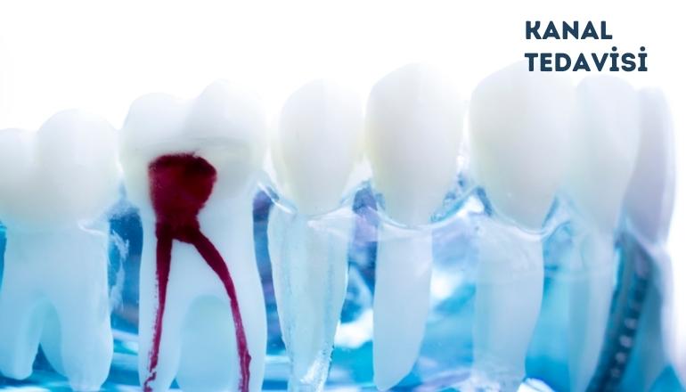 Smile Design - A balanced and natural smile designed for you.