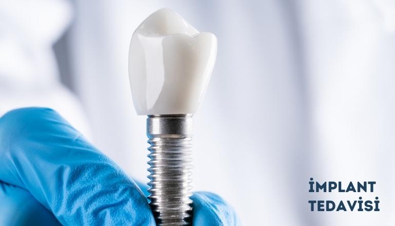 Implant Treatment - A lasting and natural-looking solution for missing teeth.